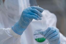 Bilanț coronavirus în România, 20 august.