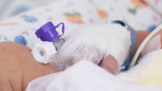 A murit copila de 2 anișori adusă în comă la spitalul Sf. Maria din Iaşi. Mama este principala suspectă