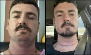 A vrut să-şi tundă părul, dar frizeriţa l-a îndemnat să meargă urgent la spital. Bărbatul din Australia a aflat că mai are doar 6 luni de trăit