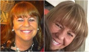 Femeia a sângerat până la moarte, după ce a fost sfâșiată de un câine