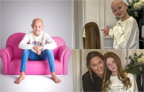 Colegii râdeau de ea pentru că este cheală