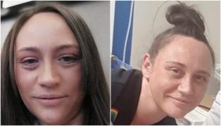 Femeia a fost declarată moartă din cauza unei erori