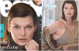 Linda Evangelista a împărtășit primele imagini cu trupul ei ''brutal desfigurat'' de o procedură cosmetică