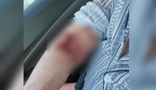 O asistentă de la Spitalul Judeţean din Târgu Jiu, acuzată că a rănit un pacient cu o foarfecă.