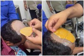 Bărbatul ascunsese aurul sub perucă