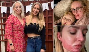 "Viețile noastre s-au schimbat radical". O noapte de distracție s-a transformat într-un coșmar fără sfârșit pentru două tinere din UK