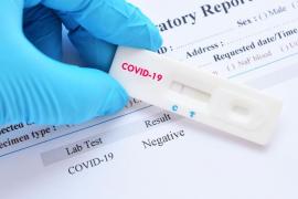 Test pentru depistarea coronavirus