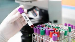 Test pentru depistarea coronavirus