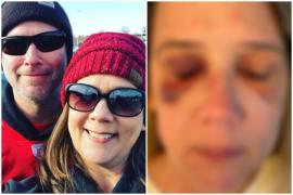 Mama fetei de 16 ani, bătută crunt de un grup de copile puse pe fapte rele