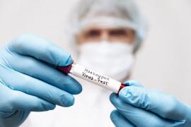 Şeful OMS va anunţa sâmbătă dacă se va declanşa cel mai mare nivel de alertă în cazul variolei maimuţei