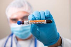 Ţara în care rujeola face ravagii: Aproape 160 de copii morţi şi mii de cazuri raportate. Decesele s-au dublat în doar câteva zile