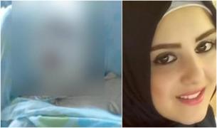 O tânără de 21 de ani luptă pentru viaţă, după ce soţul i-a dat foc