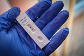 Tot mai mulţi pacienţi diagnosticaţi cu HIV/SIDA după pandemie. Medicul infecţionist Marinescu: "Avem cu 30% mai mulţi decât înainte. La hepatitele B şi C e la fel"