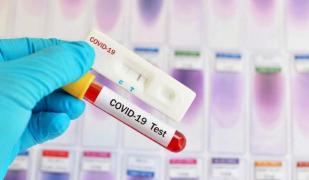 Test pentru depistarea coronavirus