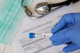Test pentru depistarea coronavirus