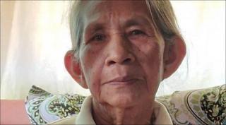 Teofila Camungay Cabusas a murit la spital din cauza arsurilor grave pe care le-a suferit