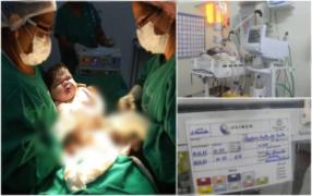 "Nu mă așteptam la o așa surpriză". Bebeluș gigant, de peste 7 kilograme, adus pe lume în Brazilia. Este cel mai mare copil născut în statul Amazonas