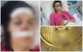 "De ce ai dat în mine, mă, idiotule?" O femeie bătută cu bestialitate pe o stradă din Ploieşti pentru că a parcat neregulamentar