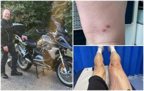 "Mi s-a spus că ar fi trebuit să mor în 48 de ore". Un tată, la un pas să moară după ce a fost mușcat de un șarpe veninos, care a mers pe motocicleta sa prin Europa