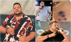 Un cunoscut cântăreț brazilian a murit fulgerător după ce a fost muşcat de față de un păianjen veninos