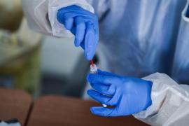 Primul caz de paralizie a corzilor vocale provocat de Covid-19. Pacienta e o tânără de 15 ani din SUA