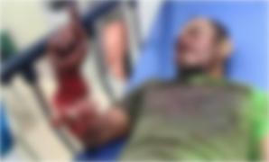 Un bărbat din Filipine a supraviețuit miraculos, după ce a fost mușcat de un șarpe. A mușcat reptila înapoi, apoi l-a dat de mâncare sătenilor