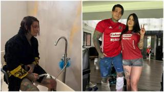 Un influencer a plătit aproape 175.000 $ pentru "cea mai dureroasă operație posibilă". Prin ce a trecut pentru a crește cu 15 centimetri