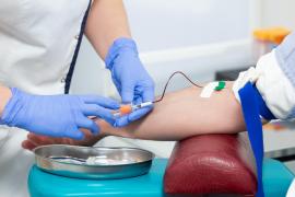 Un bărbat s-a vindecat de HIV, după un transplant de măduvă osoasă. "Pacientul de la Dusseldorf" nu mai are nicio urmă de virus în organism