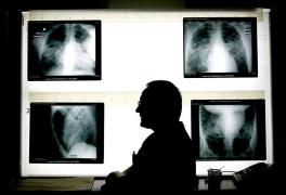 „Mi-a distrus total viața”. Un fost radiolog, acuzat de viol asupra unor paciente, condamnat la 17 ani de închisoare, în Franța. O fată de 15 ani, printre victime