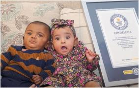 Cei mai prematuri gemeni din lume au stabilit un record Guiness la prima aniversare. Nimeni nu le dăduse vreo şansă la viaţă