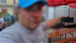 Bărbat bătut de faţă cu poliţia, în Olt. A primit un pumn în faţă de la un comerciant, după ce a sesizat că nu i-a dat bon fiscal