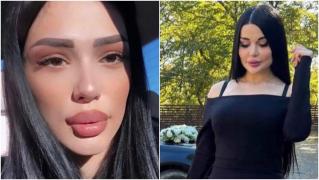 Tânără de 22 de ani, moartă după ce a vrut să-și mărească fesele într-un cabinet neautorizat, în Rusia. Prietena ei era "medicul"