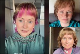 Coșmarul trăit de o australiancă după o simplă operaţie cu laser. O complicaţie i-a schimbat viaţa: "Simţeam că am cioburi de sticlă în ochii"