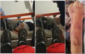 Pacientul din Brăila, legat de pat şi umilit de paznic şi infirmieră, a murit. Urmele loviturilor au rămas pe mâna bărbatului de 64 de ani