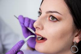 (P) Implantul dentar - secretul unui zâmbet perfect. Ghid complet al procedurii și îngrijirii post-tratament