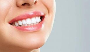 (P) Albire dentară acasă vs. albire dentară profesională: Ce alegem?