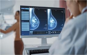 95% din cazurile de cancer la sân sunt vindecabile, dacă sunt diagnosticate la timp. Mamografia detectează ce medicul nu poate simți la palpare