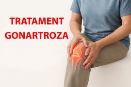 (P) Care sunt soluțiile de tratament pentru gonartroză?