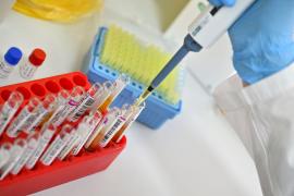 Cum ar putea fi tratat cancerul cerebral prin nas: o nouă nanoterapie promițătoare, testată cu succes în SUA