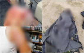 Bărbat de 74 de ani, atacat de doi câini din rasa Kangal, pe o stradă din Maramureș. A ajuns plin de sânge acasă