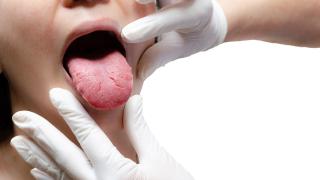 (P) Limba încărcată: cauze și boli asociate