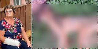 Femeie din Iaşi, atacată de un şacal turbat în propria curte: "N-am văzut niciodată așa ceva pe la noi"