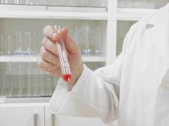 O femeie a murit de ciumă în Rusia, după ce o eprubetă s-ar fi spart la Institutul de Combatere a Ciumei