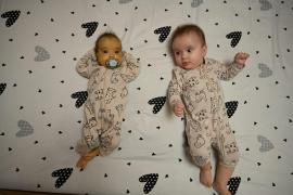 Povestea a două surori gemene de 11 luni: una e cu familia, alta în stare gravă. Cum o poţi ajuta pe Iuliana