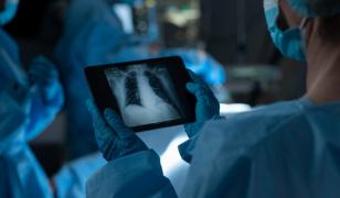 A trăit fără plămâni 48 de ore, până la transplant. Cum l-au ținut medicii în viață