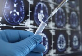 Statistică îngrijorătoare: Aproape un milion de români au boli neurologice rare