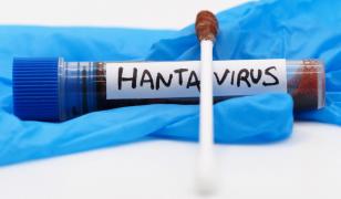 Hantavirusul, la granița cu România: "În Ucraina se înregistrează anual zeci de cazuri"