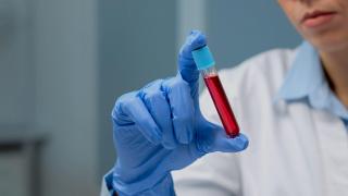 (P) Inamicii tăcuți din organism: Cum depistăm virușii care „dorm” în corpul nostru și ne sabotează imunitatea