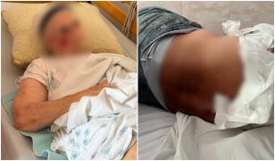 Ministerul Sănătății a evaluat 411 persoane din azilele lui Viorel Pașca. Cum au fost triate pentru relocare