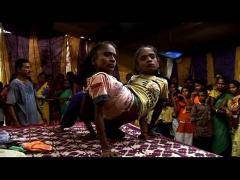 ŞOCANT! Totul se împarte la... două! Siamezele care au același IUBIT!